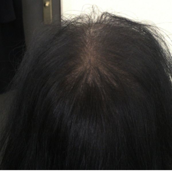 After